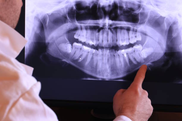 Best Broken or Chipped Tooth Repair in West Plains, MO